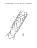 METHODS AND DEVICES FOR TREATMENT OF VASCULAR DEFECTS diagram and image