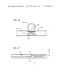 METHODS AND DEVICES FOR TREATMENT OF VASCULAR DEFECTS diagram and image