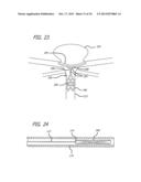 METHODS AND DEVICES FOR TREATMENT OF VASCULAR DEFECTS diagram and image