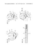 METHODS AND DEVICES FOR TREATMENT OF VASCULAR DEFECTS diagram and image