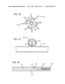 METHODS AND DEVICES FOR TREATMENT OF VASCULAR DEFECTS diagram and image