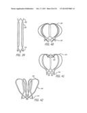 METHODS AND DEVICES FOR TREATMENT OF VASCULAR DEFECTS diagram and image