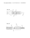 METHODS AND DEVICES FOR TREATMENT OF VASCULAR DEFECTS diagram and image