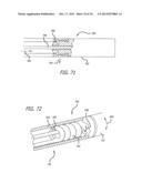 METHODS AND DEVICES FOR TREATMENT OF VASCULAR DEFECTS diagram and image