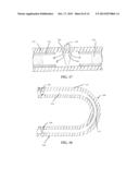 HOLLOW DRUG-FILLED STENT AND METHOD OF FORMING HOLLOW DRUG-FILLED STENT diagram and image