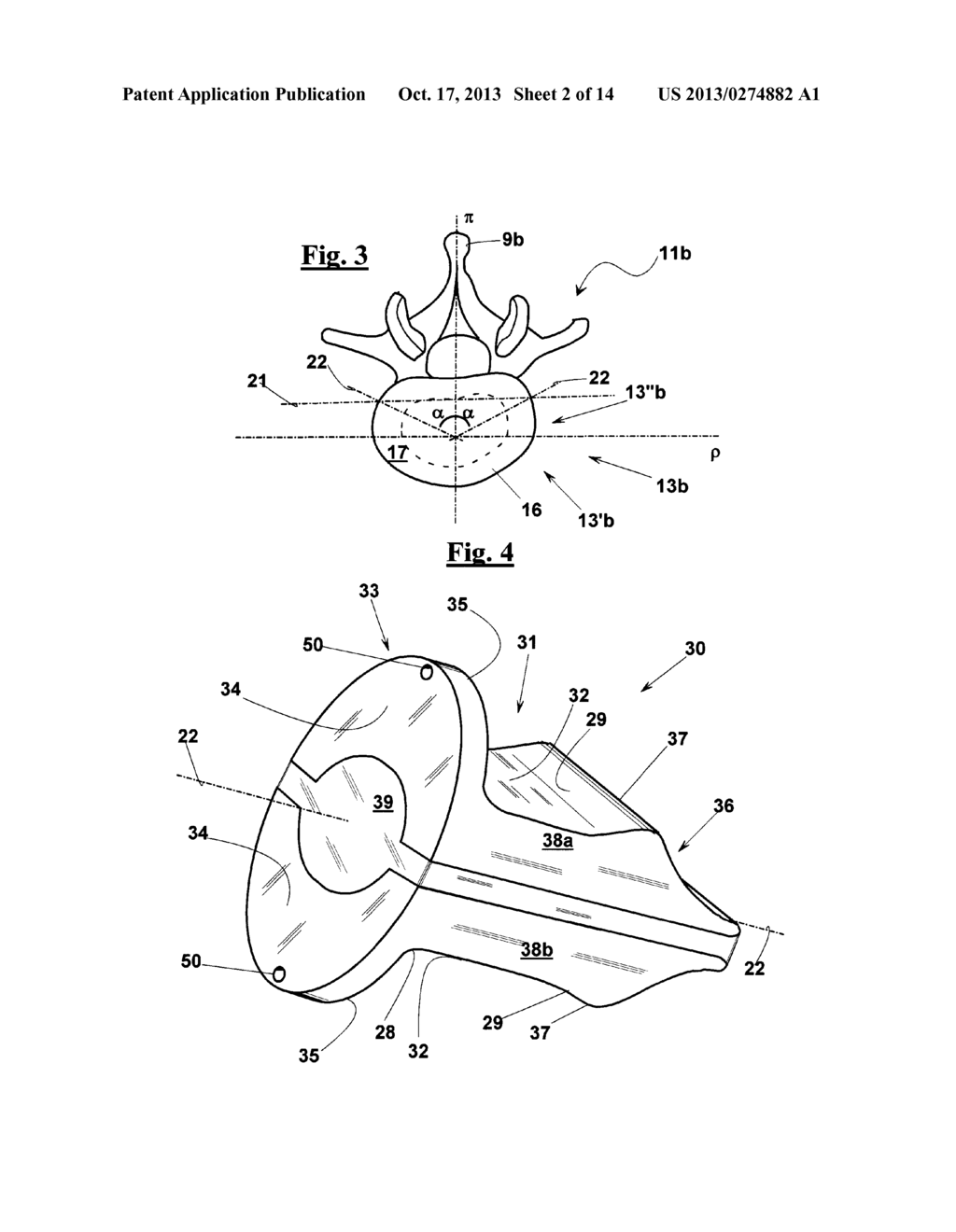 INTERVERTEBRAL SUPPORT - diagram, schematic, and image 03