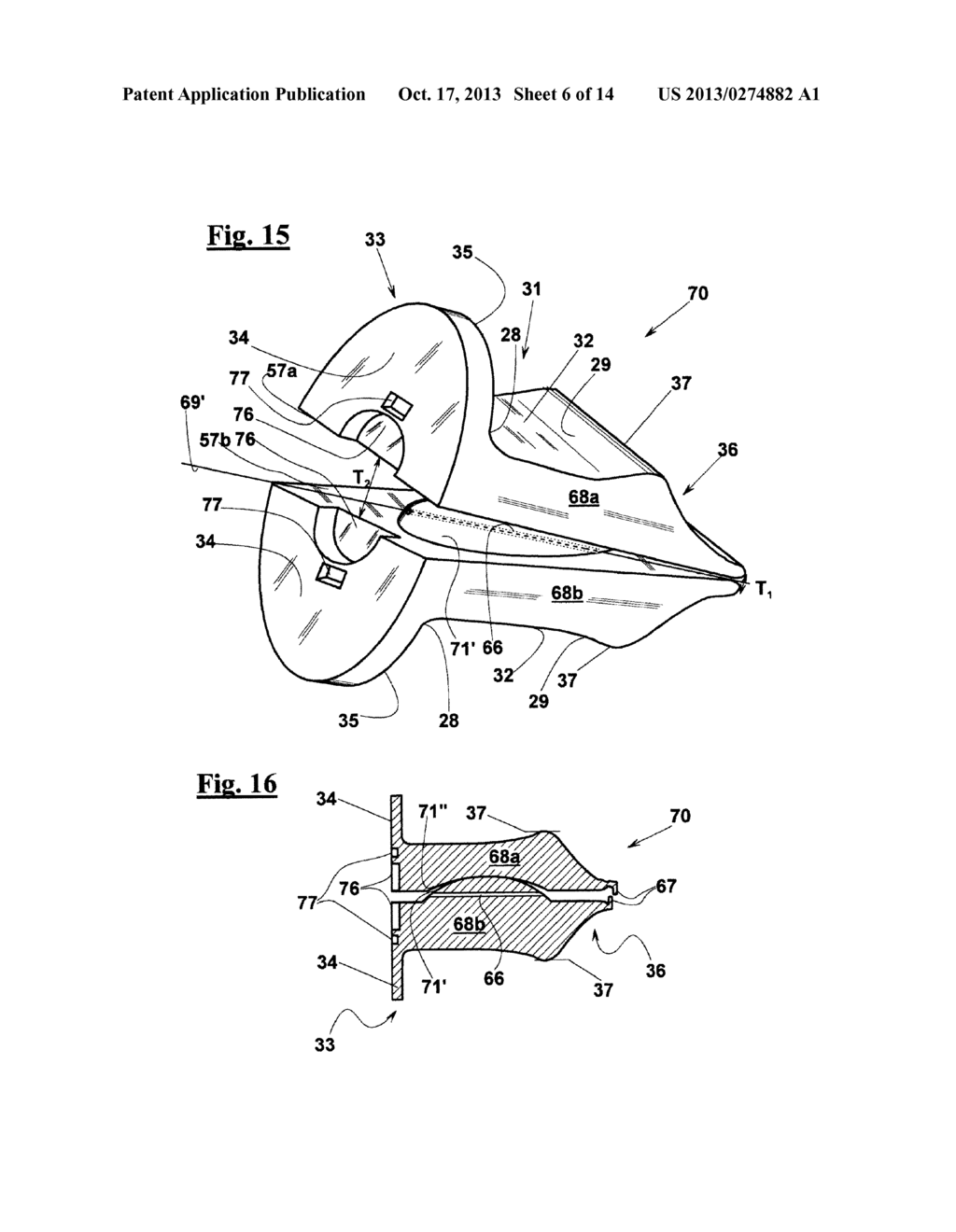 INTERVERTEBRAL SUPPORT - diagram, schematic, and image 07