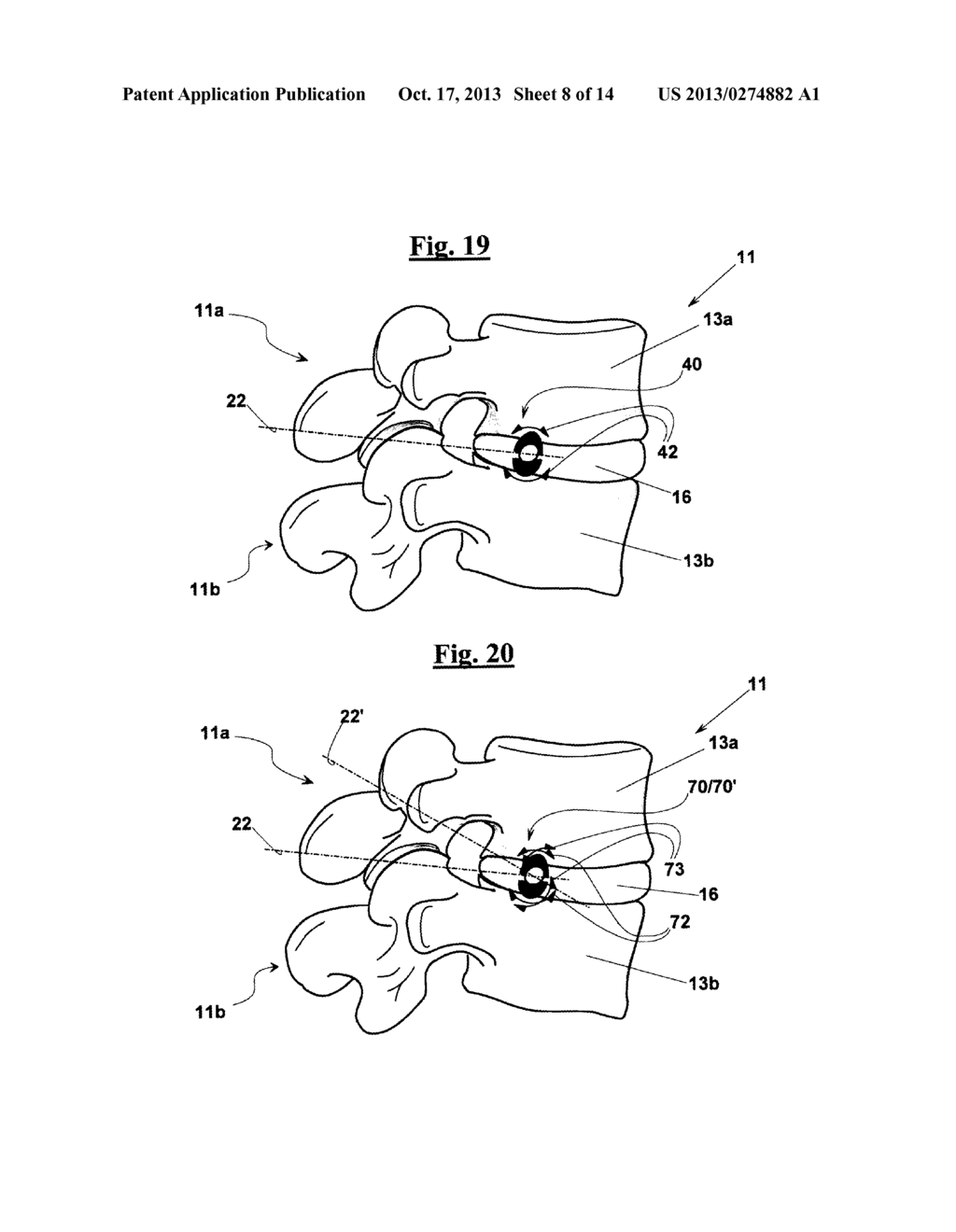 INTERVERTEBRAL SUPPORT - diagram, schematic, and image 09