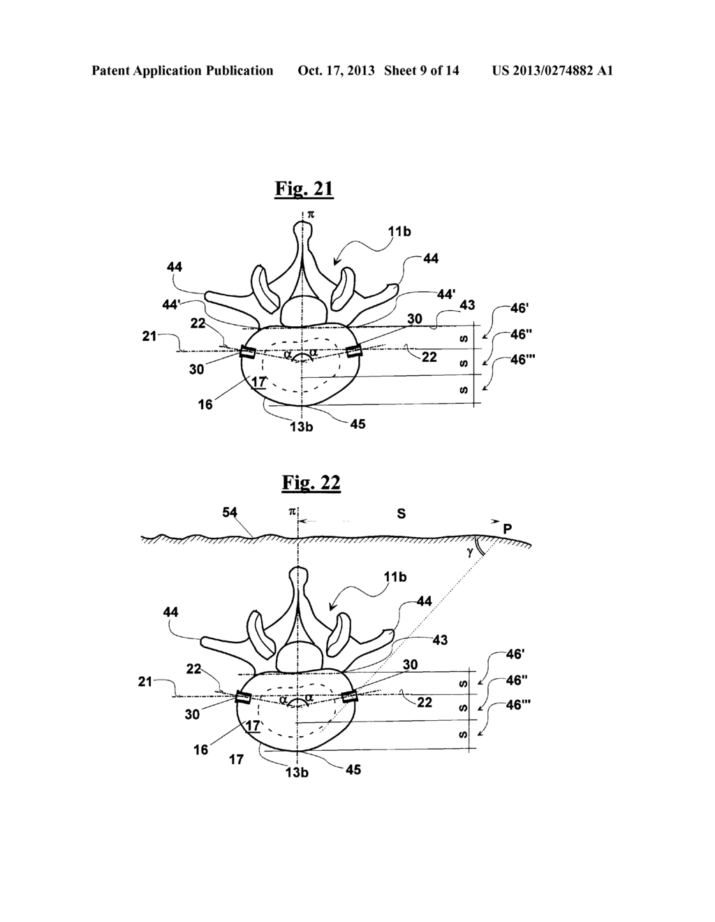 INTERVERTEBRAL SUPPORT - diagram, schematic, and image 10