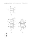 VERTEBRAL BODY SPACER diagram and image