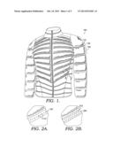 Cold Weather Vented Garment diagram and image