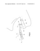 MULTI-FUNCTION BRUSH FOR OVERDENTURE diagram and image