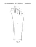 Toe Spacer Sock and Corrective Footwear diagram and image