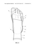 Toe Spacer Sock and Corrective Footwear diagram and image