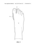 Toe Spacer Sock and Corrective Footwear diagram and image