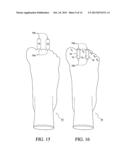 Toe Spacer Sock and Corrective Footwear diagram and image