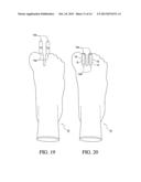 Toe Spacer Sock and Corrective Footwear diagram and image