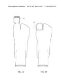 Toe Spacer Sock and Corrective Footwear diagram and image