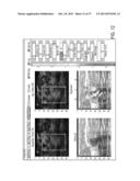 LIGHT OUTPUT CALIBRATION IN AN OPTOACOUSTIC SYSTEM diagram and image