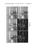 LIGHT OUTPUT CALIBRATION IN AN OPTOACOUSTIC SYSTEM diagram and image