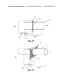 METHOD OF FORMING AN AEROSOL FOR INHALATION DELIVERY diagram and image