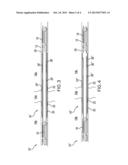 ONE TRIP TREATMENT SYSTEM WITH ZONAL ISOLATION diagram and image