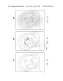 METHOD AND APPARATUS FOR RECOGNIZING THREE-DIMENSIONAL OBJECT diagram and image