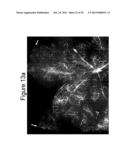 Stabilized Angiopoietin-2 Antibodies And Uses Thereof diagram and image