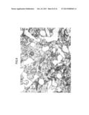 OSTEOCLASTOGENESIS INHIBITOR CONTAINING ANTI-VDAC ANTIBODY diagram and image