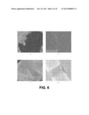 GRAPHENE DEPOSITION AND GRAPHENATED SUBSTRATES diagram and image