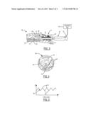 Insufflation Damper for Endoscopic Vessel Dissector/Harvester diagram and image