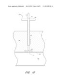 VASCULAR WOUND CLOSURE DEVICE AND METHOD diagram and image