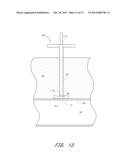 VASCULAR WOUND CLOSURE DEVICE AND METHOD diagram and image