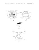 WEARABLE REMOTE ELECTROPHYSIOLOGICAL MONITORING SYSTEM diagram and image