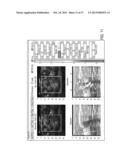 NOISE SUPPRESSION IN AN OPTOACOUSTIC SYSTEM diagram and image