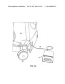 NOISE SUPPRESSION IN AN OPTOACOUSTIC SYSTEM diagram and image