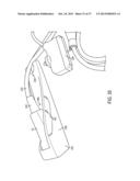 NOISE SUPPRESSION IN AN OPTOACOUSTIC SYSTEM diagram and image