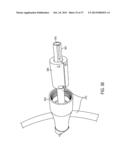 NOISE SUPPRESSION IN AN OPTOACOUSTIC SYSTEM diagram and image