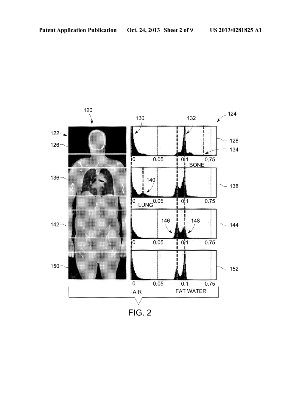 ATTENUATION CORRECTION IN POSITRON EMISSION TOMOGRAPHY USING MAGNETIC     RESONANCE IMAGING - diagram, schematic, and image 03