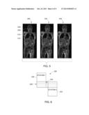 ATTENUATION CORRECTION IN POSITRON EMISSION TOMOGRAPHY USING MAGNETIC     RESONANCE IMAGING diagram and image