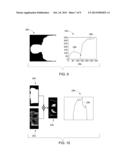 ATTENUATION CORRECTION IN POSITRON EMISSION TOMOGRAPHY USING MAGNETIC     RESONANCE IMAGING diagram and image