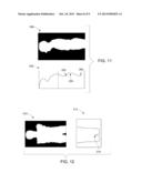 ATTENUATION CORRECTION IN POSITRON EMISSION TOMOGRAPHY USING MAGNETIC     RESONANCE IMAGING diagram and image