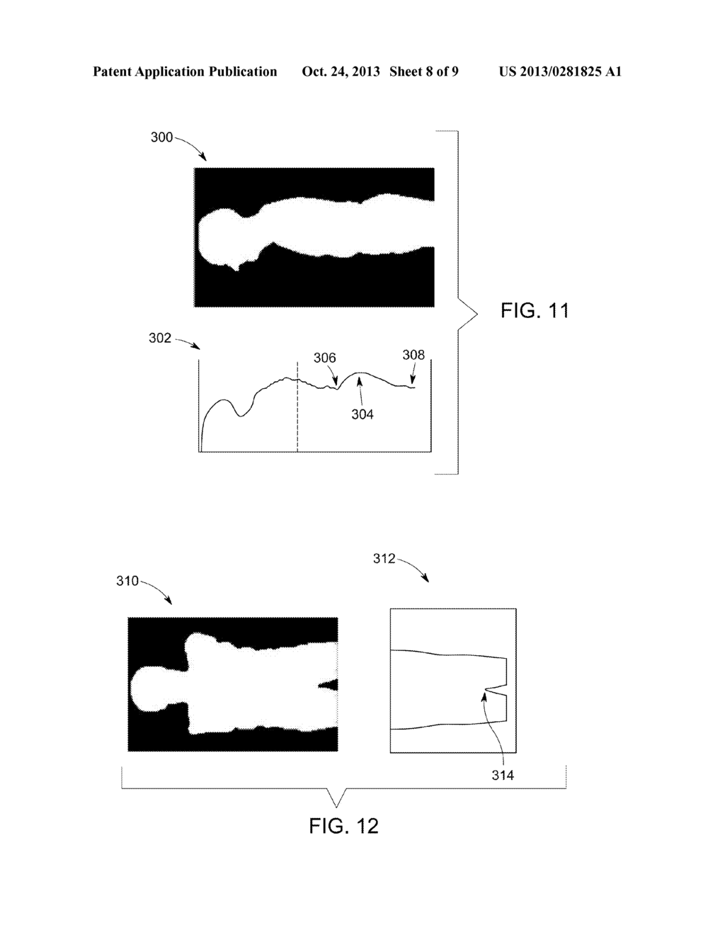 ATTENUATION CORRECTION IN POSITRON EMISSION TOMOGRAPHY USING MAGNETIC     RESONANCE IMAGING - diagram, schematic, and image 09