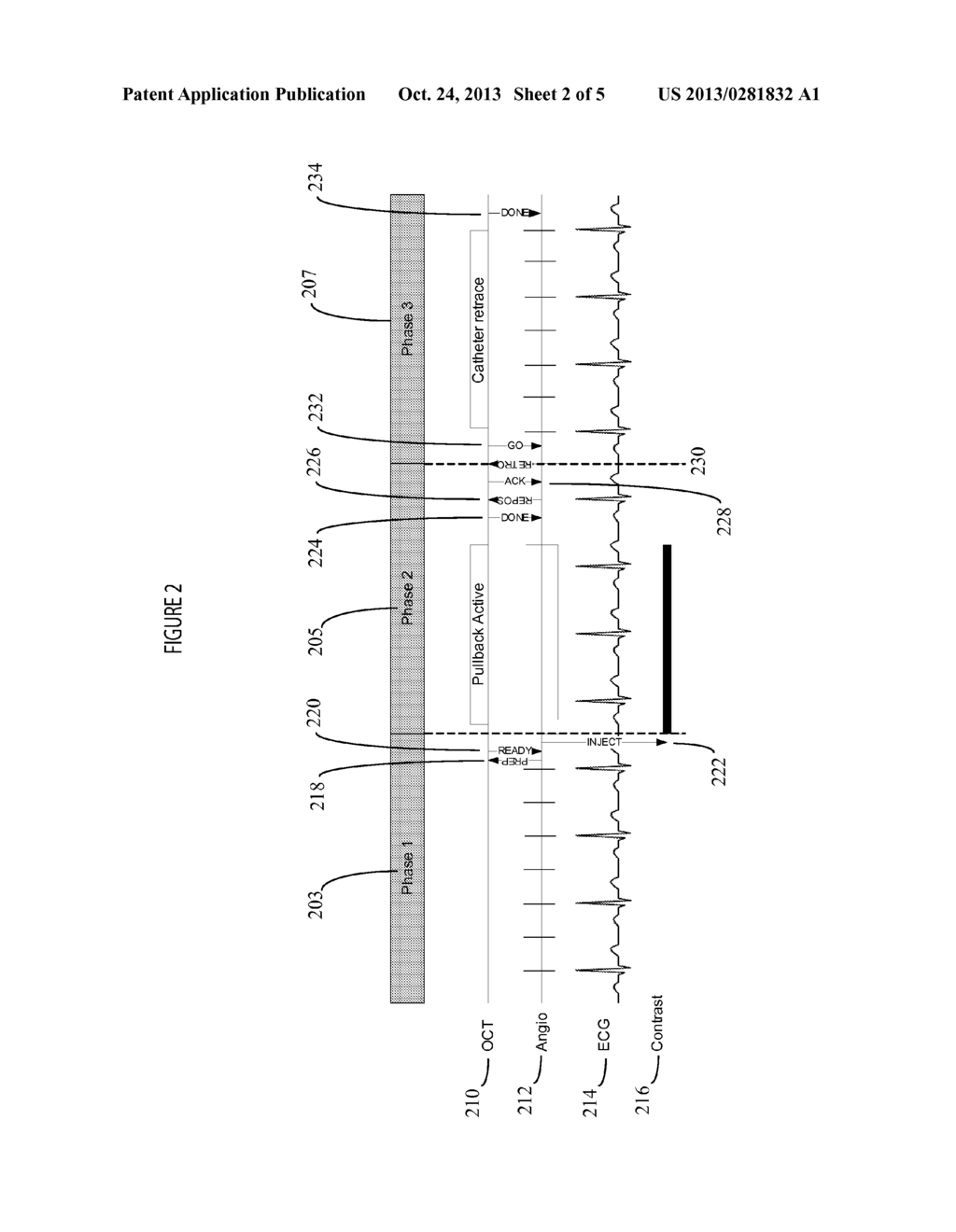 System for Coregistration of Optical Coherence Tomography and Angiographic     X-ray Image Data - diagram, schematic, and image 03