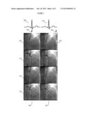 System for Coregistration of Optical Coherence Tomography and Angiographic     X-ray Image Data diagram and image