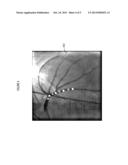 System for Coregistration of Optical Coherence Tomography and Angiographic     X-ray Image Data diagram and image