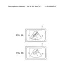 ULTRASOUND DIAGNOSTIC APPARATUS AND ULTRASOUND IMAGE DISPLAY METHOD diagram and image