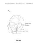 NONINVASIVE TISSUE TIGHTENING FOR COSMETIC EFFECTS diagram and image