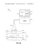 NONINVASIVE TISSUE TIGHTENING FOR COSMETIC EFFECTS diagram and image