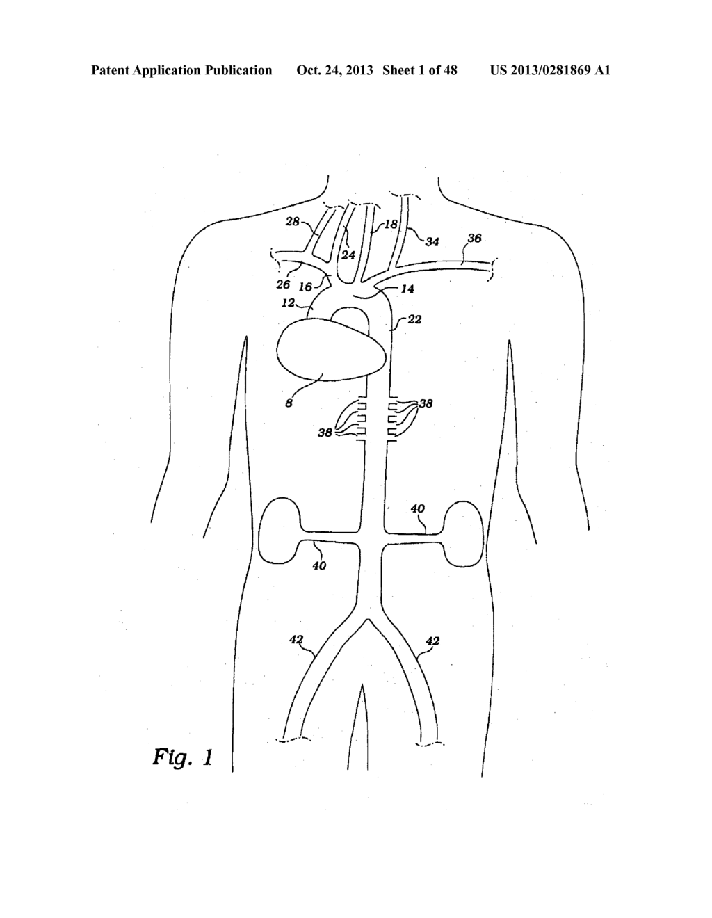 PARTIAL AORTIC OCCLUSION DEVICES AND METHODS FOR CEREBRAL PERFUSION     AUGMENTATION - diagram, schematic, and image 02